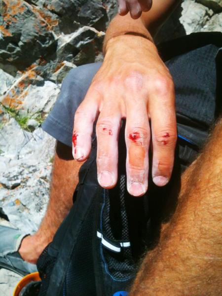 Dom's not so fresh skin. This didn't limit his climbing too much but it was disgusting for me, having to use the same blood covered holds he had touched!